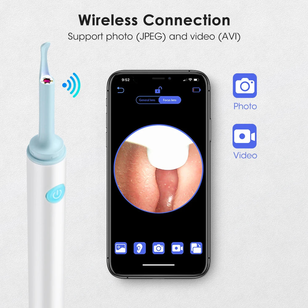 OtoCam™ Smart Clean